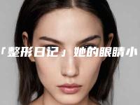 「整形日记」她的眼睛小到天际,做个双眼皮酥炸少女心!
