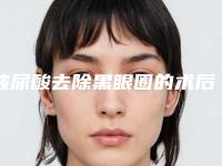玻尿酸去除黑眼圈的术后副作用
