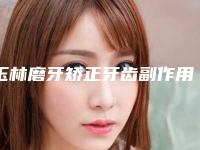 玉林磨牙矫正牙齿副作用有多少