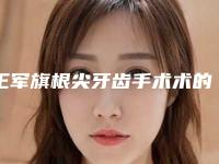 王军旗根尖牙齿手术术的作用会持续多长时间
