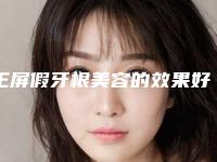 王屏假牙根美容的效果好不好(王屏假牙根术有哪些功效)