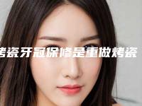 烤瓷牙冠保修是重做烤瓷牙冠和全瓷牙冠区别