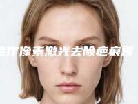 焦作像素激光去除疤痕需要的费用(价格)