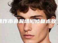 焦作市鼻翼塌陷修复术收费明细完整(焦作市鼻翼塌陷修复术整容术价格)
