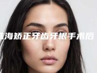 珠海矫正牙齿牙根手术后护理要点