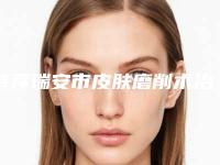 特荐瑞安市皮肤磨削术治疗雀斑价格多少贵不贵在线查看皮肤磨削术治疗雀斑大概得费用是多少钱