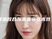 牙齿咬合深覆盖牵引术效果好不好价格是多少