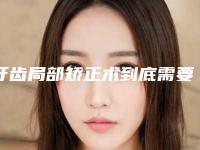 牙齿局部矫正术到底需要多少钱