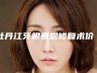 牡丹江牙根暴露修复术价格查询