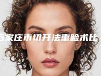 石家庄市切开法重睑术比较好的正规的有哪些-石家庄市切开法重睑术整形医院