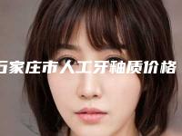 石家庄市人工牙釉质价格表(费用)项目大全介绍-石家庄市人工牙釉质价格