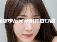 盘锦市后牙牙根打桩口腔医生上榜清单获网友好评-盘锦市后牙牙根打桩医生看谁更胜一筹