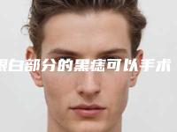 眼白部分的黑痣可以手术去除吗?