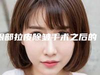 眼部拉皮除皱手术之后的保健护理措施