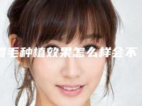 眉毛种植效果怎么样会不会掉