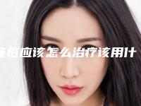 痤疮应该怎么治疗该用什么药膏(痤疮应该怎么治疗图片)