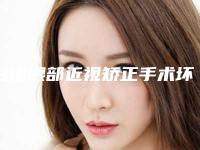 白山眼部近视矫正手术坏处有什么