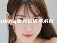 白山大q激光祛斑手术效果能持续多长时间