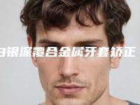 白银深覆合金属牙套矫正对肌肤会不会有伤害
