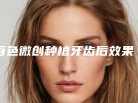 百色微创种植牙齿后效果不明显怎么办