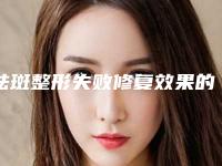 祛斑整形失败修复效果的因素