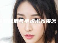 硅胶隆眉弓手术术效果怎么样价格大概是多少