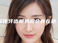 绥化牙齿根外露会存在危害吗(绥化牙齿根外露术后有什么危害)