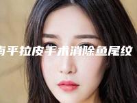 南平拉皮手术消除鱼尾纹的适应人群都有哪些