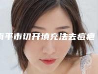 南平市切开填充法去痘疤手术医院-南平华美整形美容外科门诊医疗中心医美top8获好评