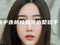 南平连桥修复牙齿整容手术效果好不好