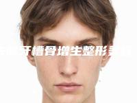 去除牙槽骨增生整形美容适应人群具体有哪些