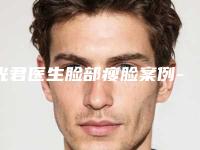 光君医生脸部瘦脸案例-价格表(费用)2.0专家资料拔草