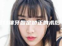 全口镶牙固定矫正的术后护理有哪些