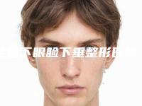 全国下眼睑下垂整形医院排名前二十强查收-个个特色鲜明