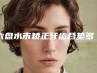 六盘水市矫正牙齿合垫多少钱-六盘水市矫正牙齿合垫医院排行优先对外公示