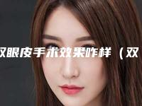 双眼皮手术效果咋样(双眼皮手术效果咋样啊)