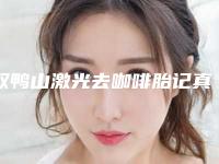 双鸭山激光去咖啡胎记真的有危害吗