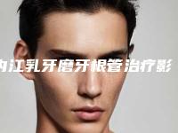 内江乳牙磨牙根管治疗影响皮肤吗
