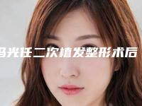 冯光任二次植发整形术后护理办法