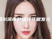 哈尔滨市种植牙牙龈发炎医生排名榜十强权威点评-哈尔滨市徐刚口腔医生