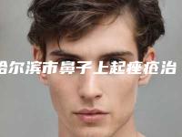 哈尔滨市鼻子上起痤疮治疗医生排行榜十强大评比-刘东辉医生个个实力强横