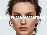 哈尔滨补牙切开牙龈整形术安不安全