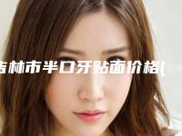 吉林市半口牙贴面价格(费用)清单万众瞩目而来-吉林市半口牙贴面价格