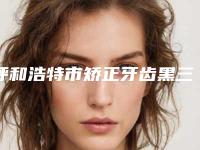 呼和浩特市矫正牙齿黑三角医生上榜名单前十位倾情奉献-呼和浩特市矫正牙齿黑三角口腔医生