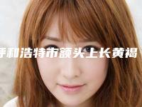 呼和浩特市额头上长黄褐斑去除医院在榜清单前十佳综合汇总(呼和浩特崔大夫医疗美容美体中心分析哪个效果更好)