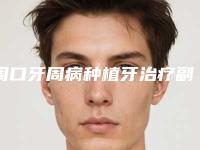 周口牙周病种植牙治疗副作用