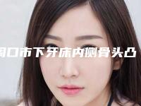 周口市下牙床内侧骨头凸起价格表最新发布医院资料曝光(下牙床内侧骨头凸起均价为:6354元)