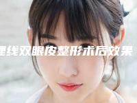 埋线双眼皮整形术后效果不长久怎么办（双眼皮埋线后效果不好怎么办）