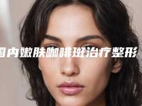 国内嫩肤咖啡斑治疗整形医院推荐：嫩肤咖啡斑治疗医院top50均是实力派