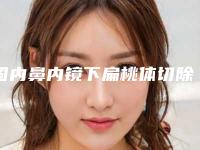 国内鼻内镜下扁桃体切除术医院排行榜：鼻内镜下扁桃体切除术医院前50一览名单更新